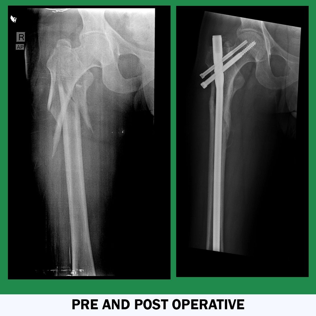 Pre And Post Operative